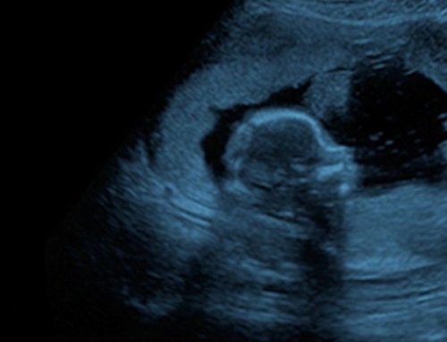 ISUOG and FMF present Ultrasound Essentials 2023